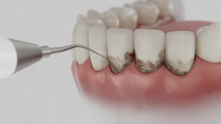 Reliable Dental Implants contractor in Maple Lake, MN by Smile Center Dentistry